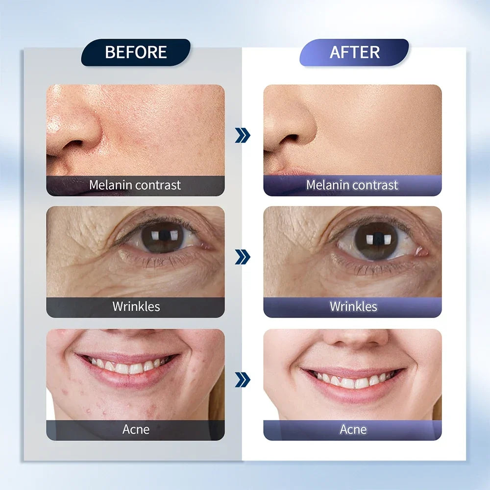 7-colour LED Photon Face Mask &amp; Nano Spray Machine - Skin Rejuvenation Anti-Aging Home Therapy