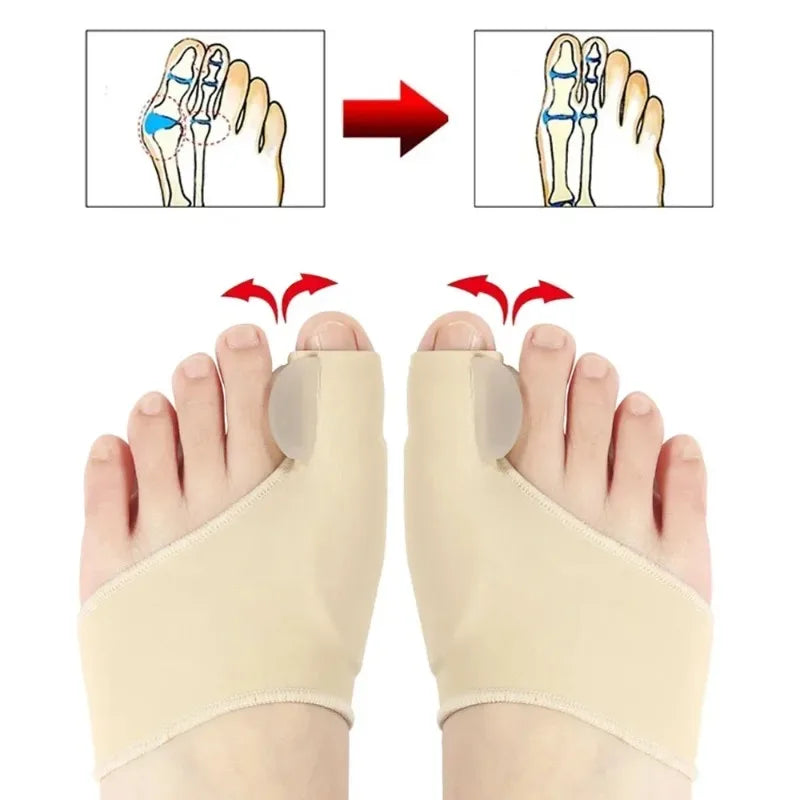 Hallux Valgus Bunion Corrector Toe Separator Set – Orthopedic Foot Straightener Relief 2026