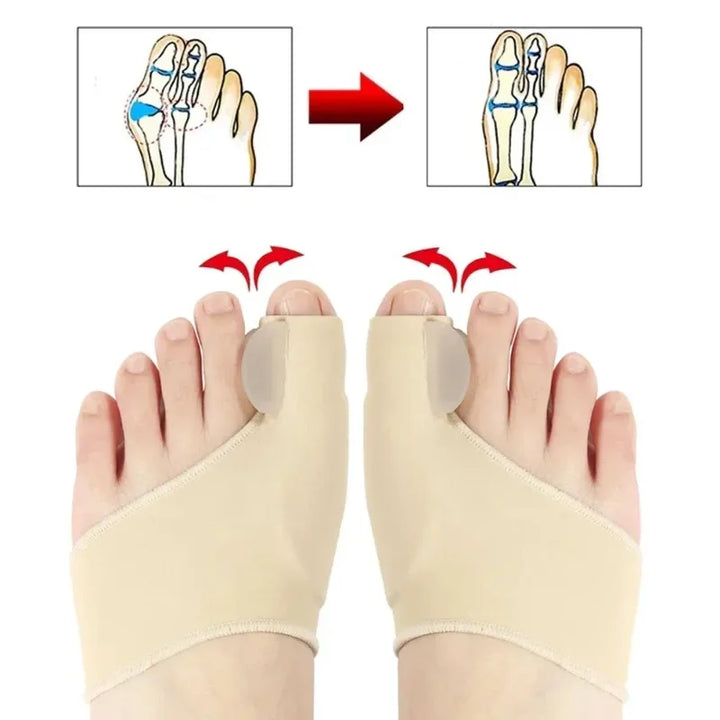 Hallux Valgus Bunion Corrector Toe Separator Set – Orthopedic Foot Straightener Relief 2026