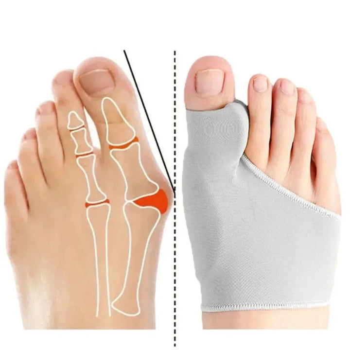 Hallux Valgus Bunion Corrector Toe Separator Set – Orthopedic Foot Straightener Relief 2026